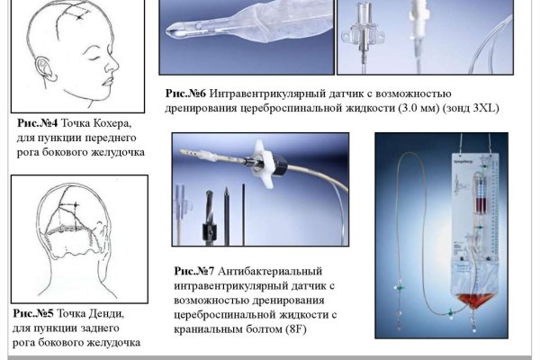 Нарко магазин кракен
